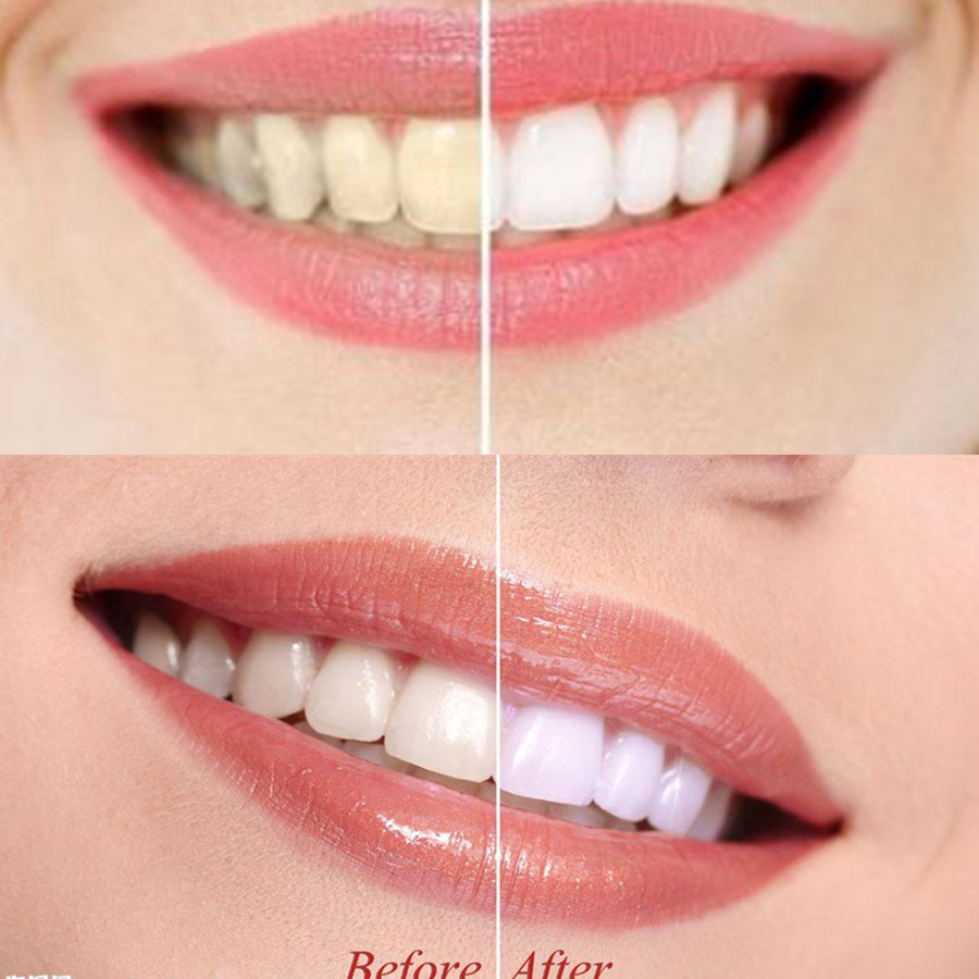 Bamboo Charcoal Teeth Tooth De - Teeth Whitening Price recension och pris