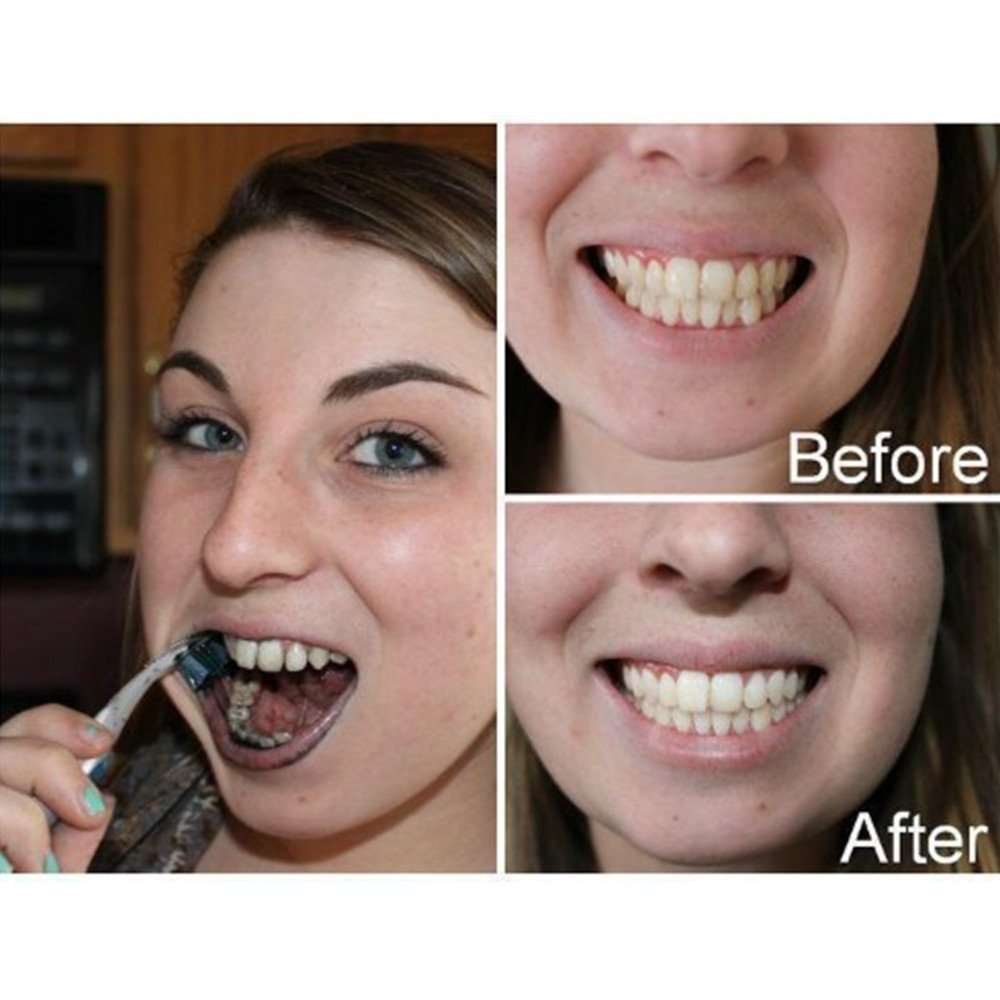 Bamboo Charcoal Teeth Tooth De - Teeth Whitening Price recension och pris