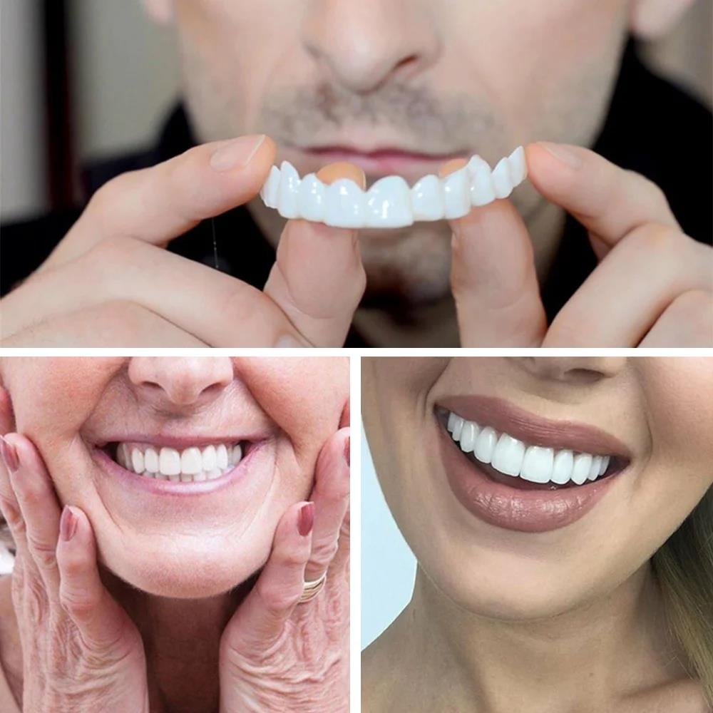 New KOL Influencer Teeth Venee - Teeth Whitening Video recension och pris