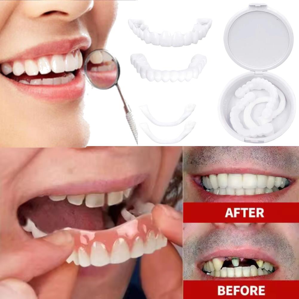 New KOL Influencer Teeth Venee - Teeth Whitening Video recension och pris