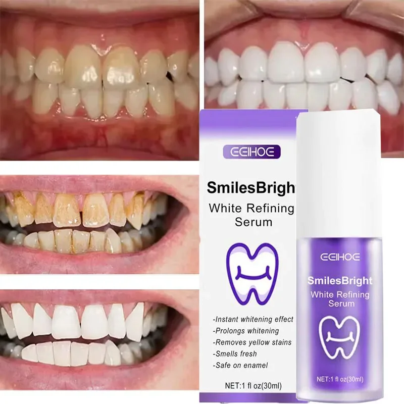 Teeth Cleansing Whitening Toot - Teeth Whitening In Korea recension och pris