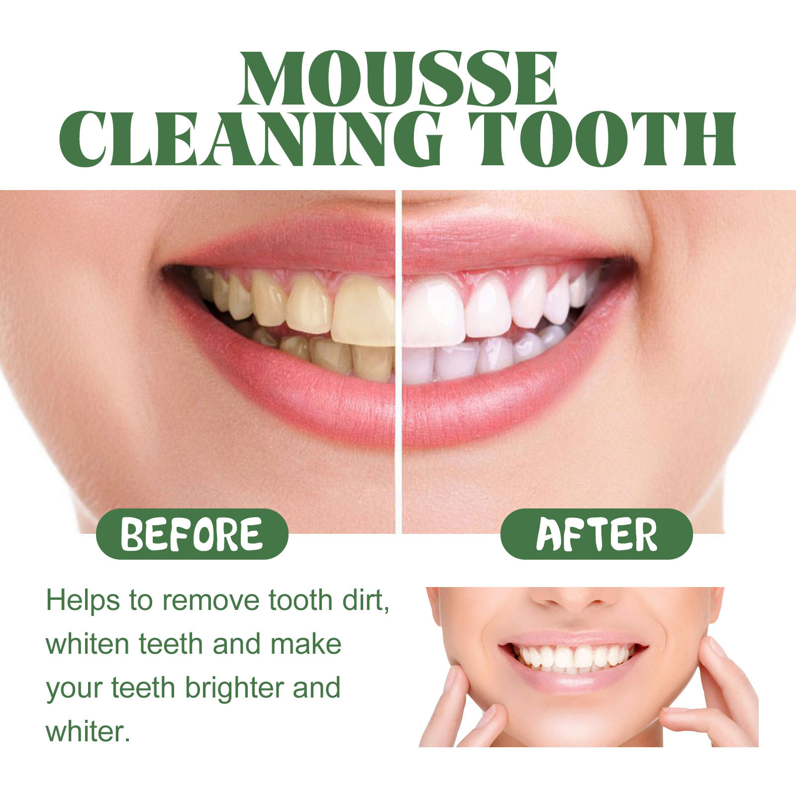 Portable Travel Size Whitening - Teeth Whitening Mousse recension och pris