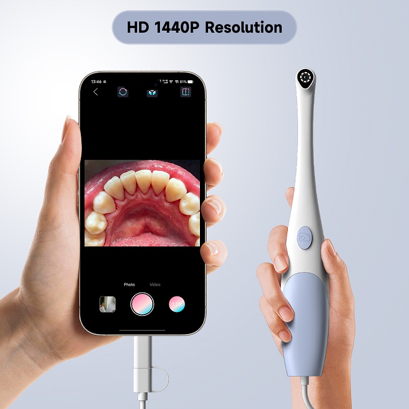 Oral Endoscope Camera 1440P Ph - Teeth Whitening Video recension och pris