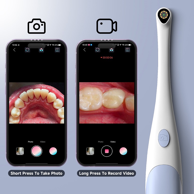 Oral Endoscope Camera 1440P Ph - Teeth Whitening Video recension och pris