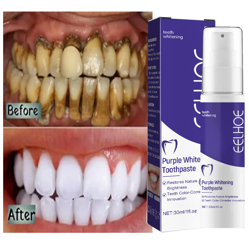 1pcs Teeth Cleansing Whitening - Teeth Whitening In Korea recension och pris