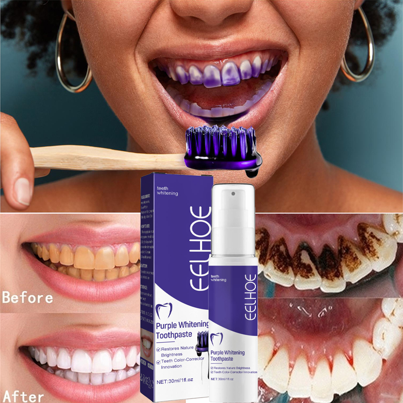 1pcs Teeth Cleansing Whitening - Teeth Whitening In Korea recension och pris