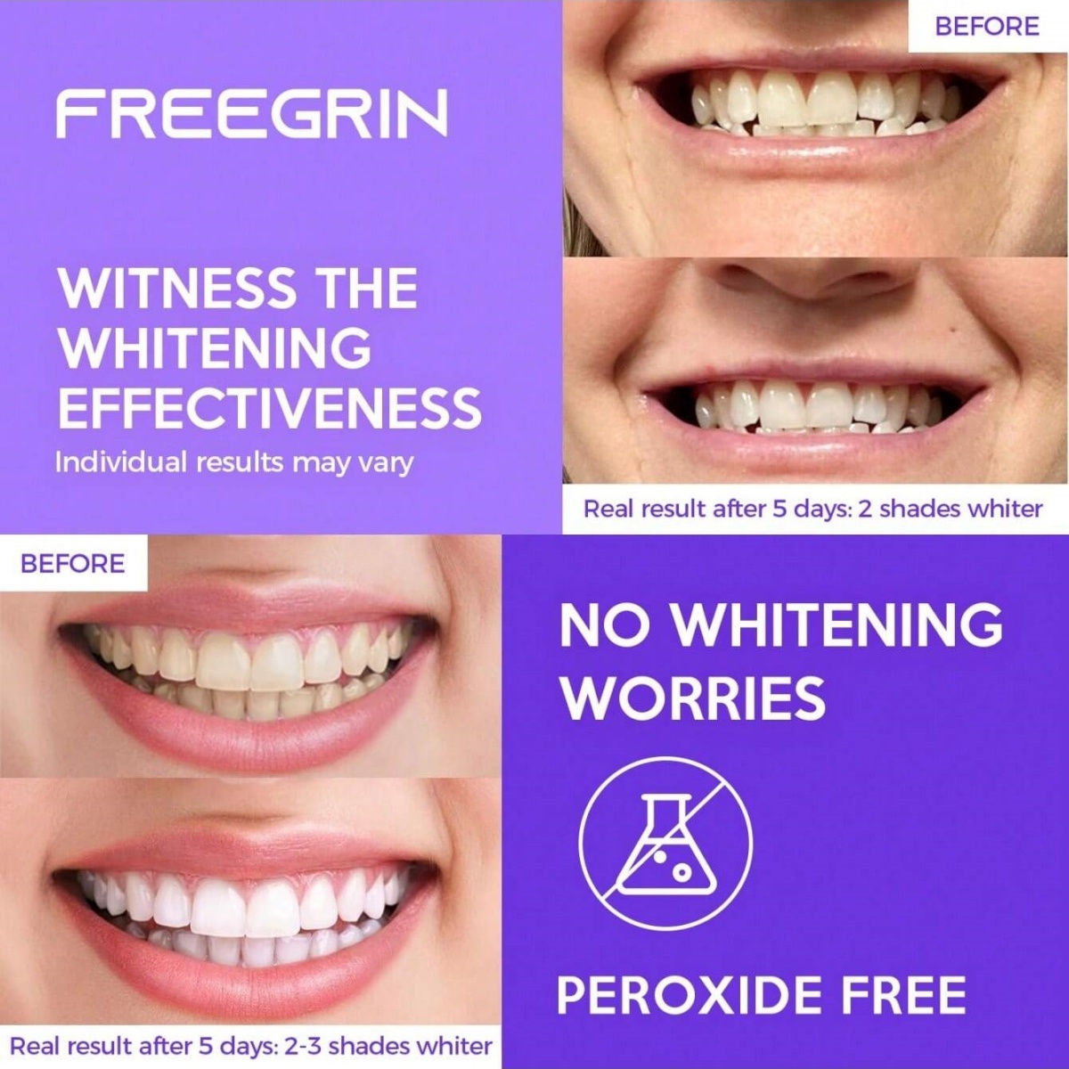Deluxe Whitening Teeth Sticker - Teeth Whitening Price recension och pris
