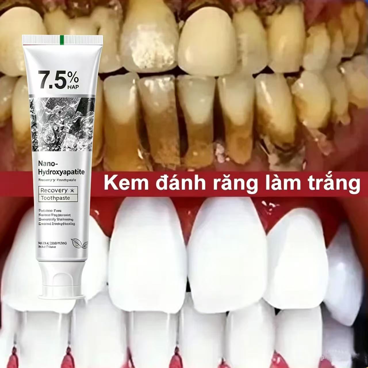 7.5% Hydroxyapatite Probiotic  - Teeth Whitening That Works recension och pris