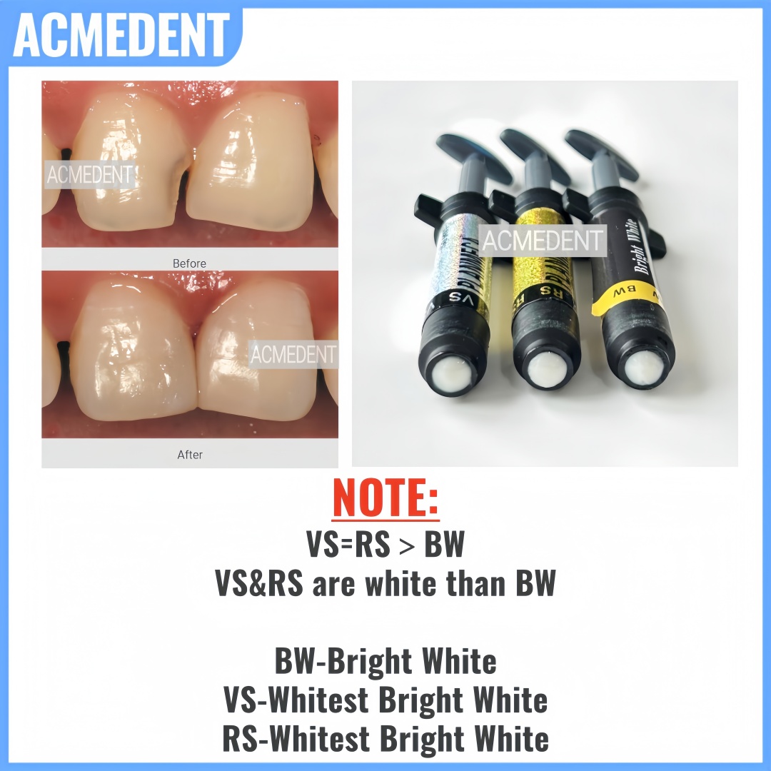 4.5g Dental Composite Resin Ve - Teeth Whitening Vs Veneers recension och pris