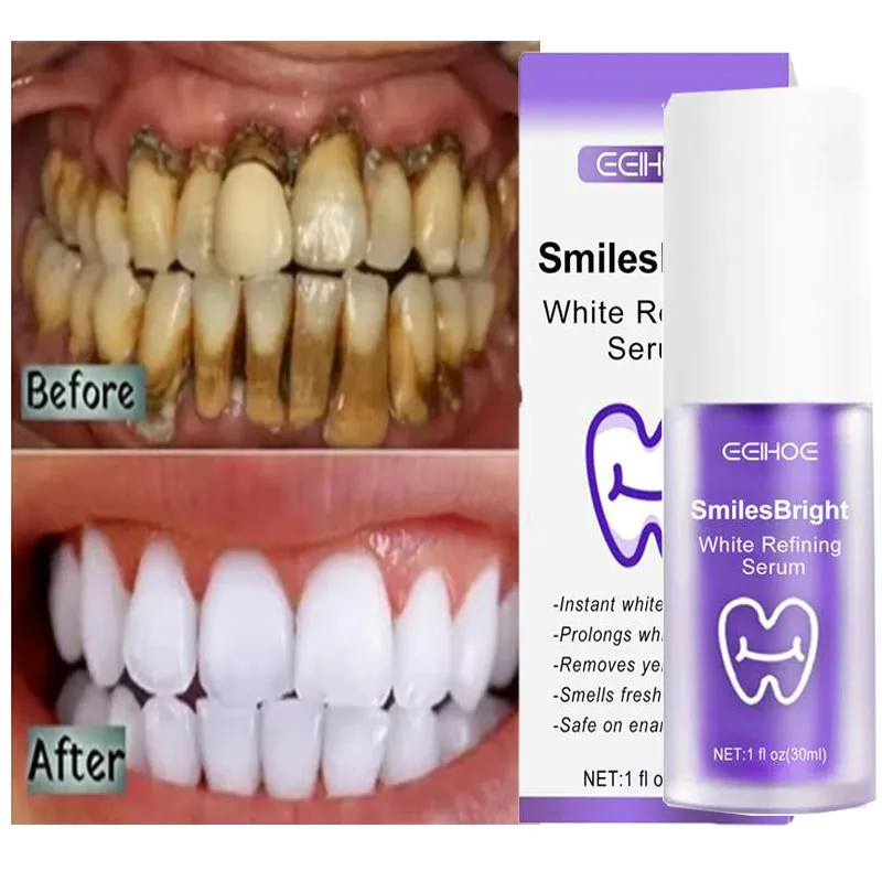Whitening Toothpaste Teeth Cle - Teeth Whitening In Korea recension och pris