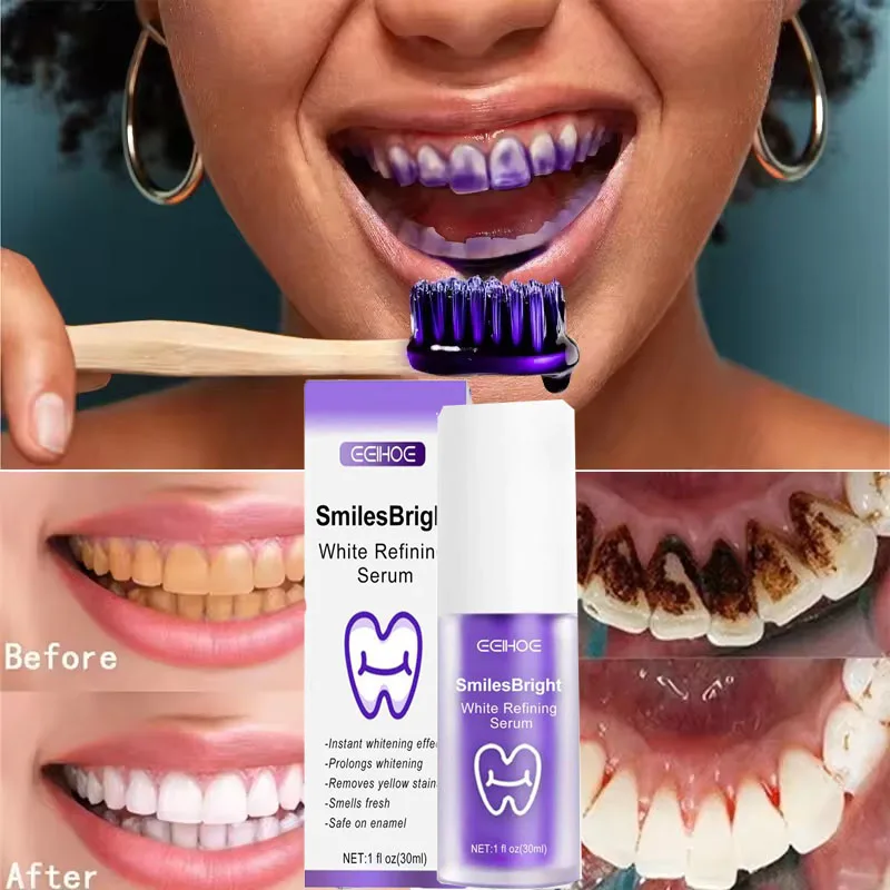 Whitening Toothpaste Teeth Cle - Teeth Whitening In Korea recension och pris