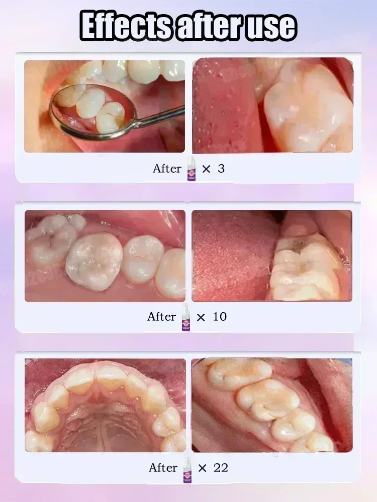 Teeth Cleaning Toothpaste Remo - Teeth Whitening Toothpaste recension och pris