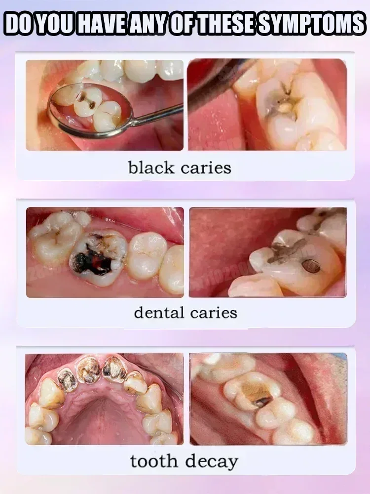 Teeth Cleaning Toothpaste Remo - Teeth Whitening Toothpaste recension och pris